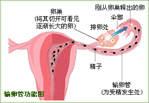 輸卵管阻塞性不孕